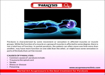 PARALYSIS
