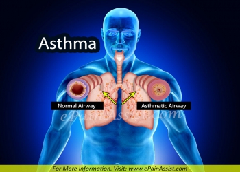 ASTHMA / BREATHLESSNESS / SUFFOCATION