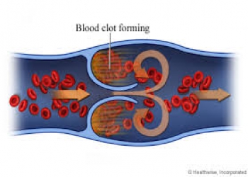 CLOTTING OF BLOOD